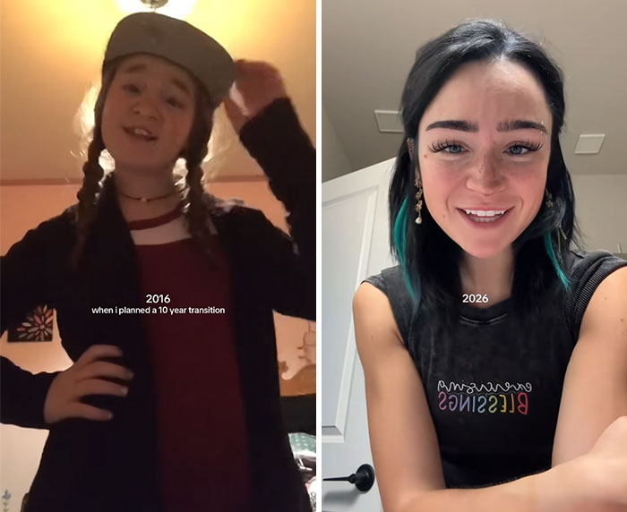 65 Then-and-Now Pics That Make You Go "Wait, Is That Even The Same Person?"