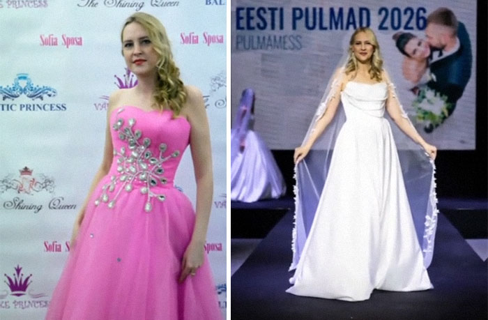 65 Then-and-Now Pics That Make You Go "Wait, Is That Even The Same Person?"