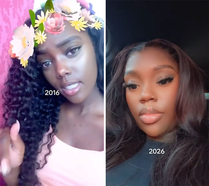 65 Then-and-Now Pics That Make You Go "Wait, Is That Even The Same Person?"