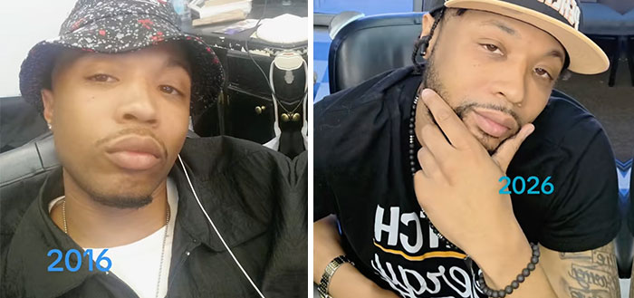 65 Then-and-Now Pics That Make You Go "Wait, Is That Even The Same Person?"