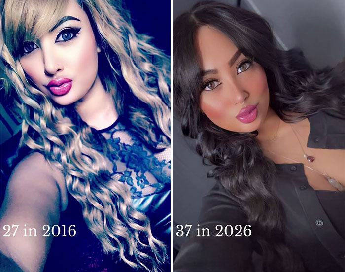 65 Then-and-Now Pics That Make You Go "Wait, Is That Even The Same Person?"