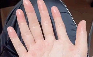Wait, People Have These Wild Physical Features?!