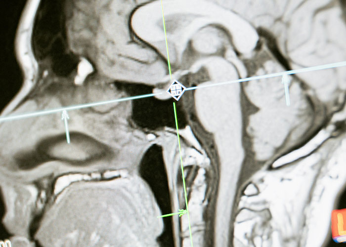 Wait, People Have These Wild Physical Features?!