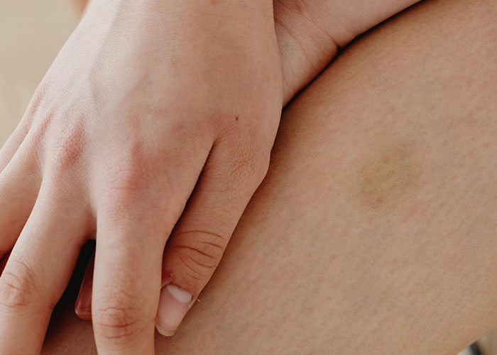 Wait, People Have These Wild Physical Features?!