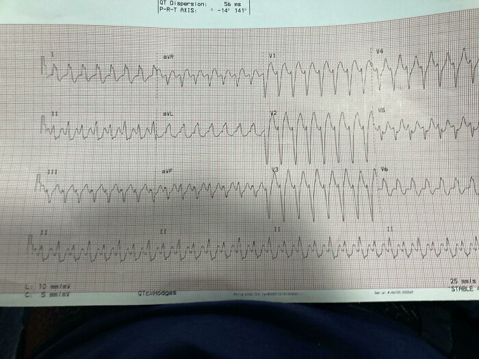 46 Weird Medical Facts That’ll Make You Go Huh?