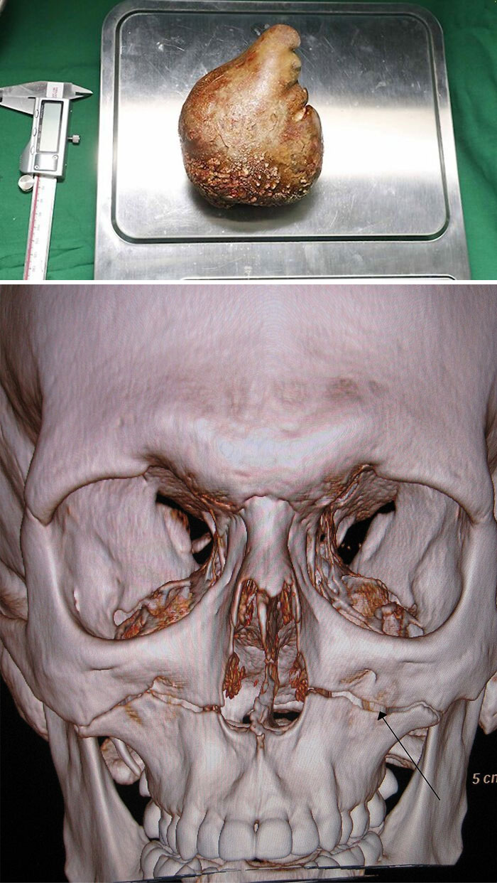 46 Weird Medical Facts That’ll Make You Go Huh?