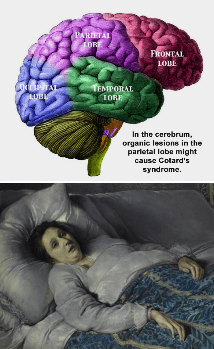 46 Weird Medical Facts That’ll Make You Go Huh?