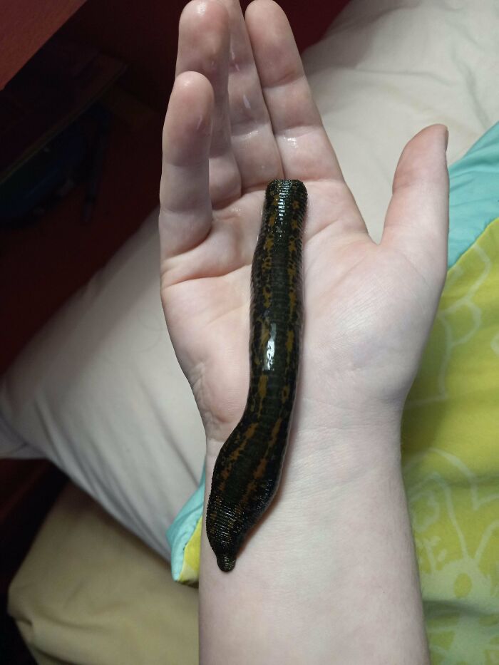 46 Weird Medical Facts That’ll Make You Go Huh?