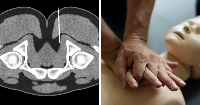 Wait, They Actually Ranked These Crazy Medical Mind-Blowers?!