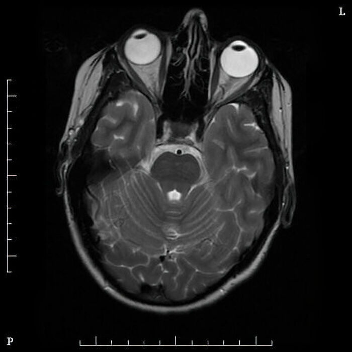 Wait, They Actually Ranked These Crazy Medical Mind-Blowers?!