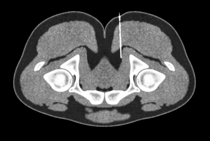 Wait, They Actually Ranked These Crazy Medical Mind-Blowers?!