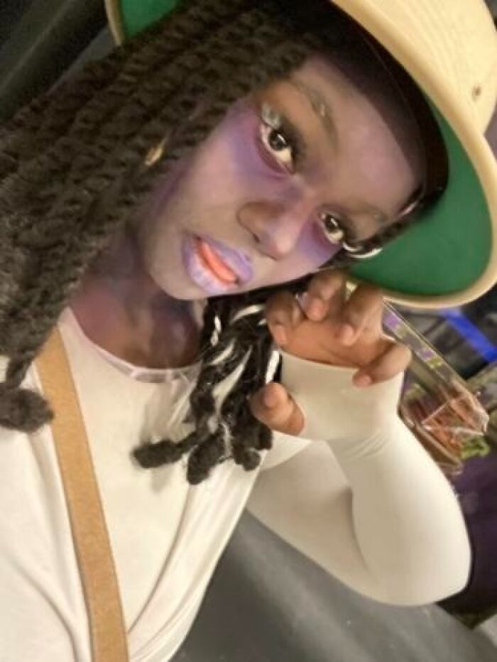 Girl Me Too (My Skin Was Screaming For Days After My Show)