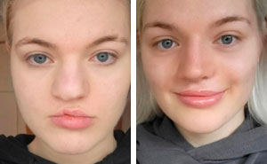 41 Plastic Surgery Glow-Ups That Will Make You Look Twice