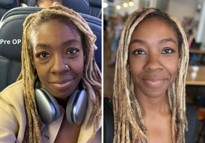 41 Plastic Surgery Glow-Ups That Will Make You Look Twice