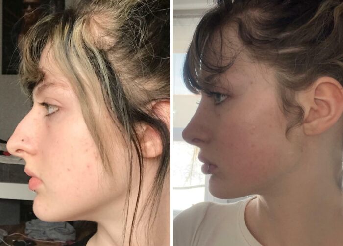 41 Plastic Surgery Glow-Ups That Will Make You Look Twice