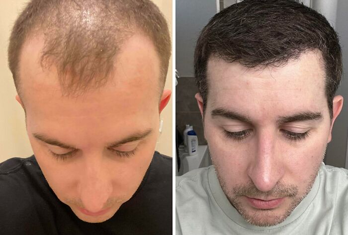 41 Plastic Surgery Glow-Ups That Will Make You Look Twice