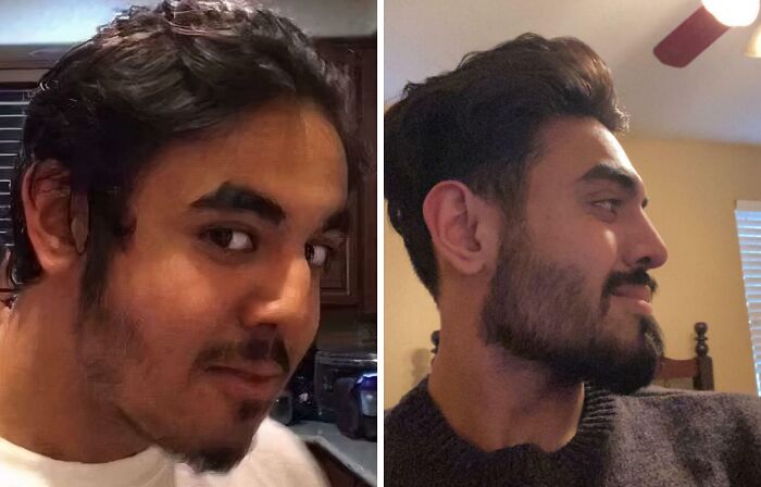 41 Plastic Surgery Glow-Ups That Will Make You Look Twice