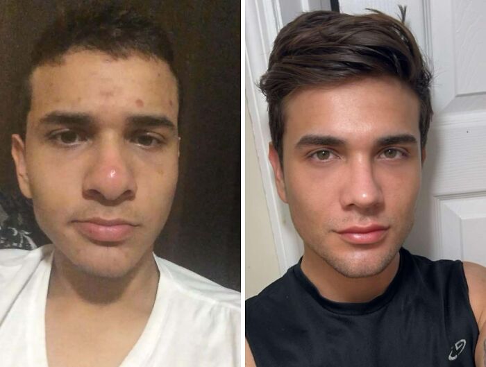 41 Plastic Surgery Glow-Ups That Will Make You Look Twice