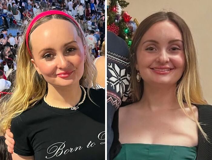 41 Plastic Surgery Glow-Ups That Will Make You Look Twice