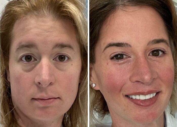 41 Plastic Surgery Glow-Ups That Will Make You Look Twice