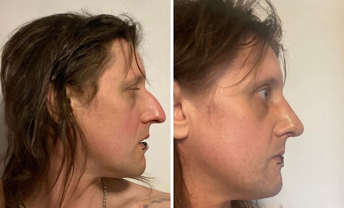 41 Plastic Surgery Glow-Ups That Will Make You Look Twice