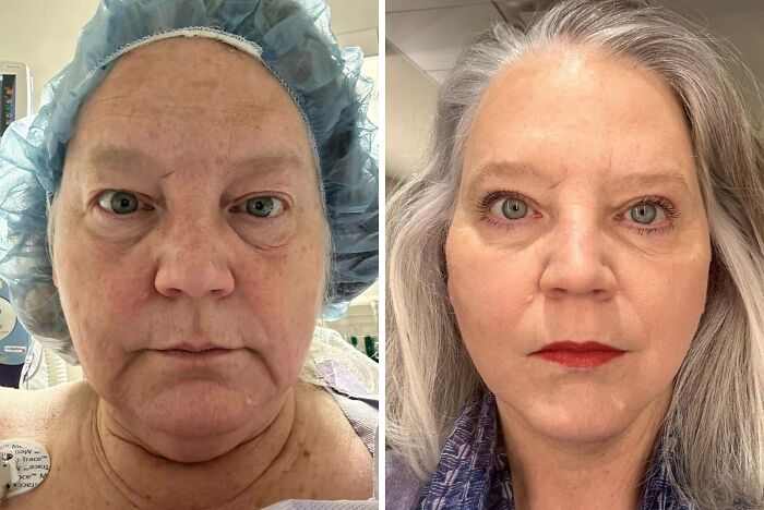 41 Plastic Surgery Glow-Ups That Will Make You Look Twice