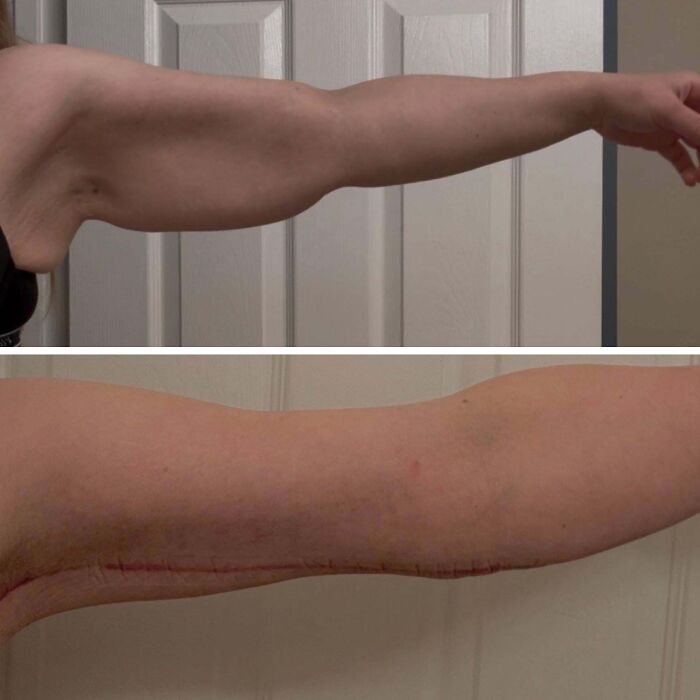 41 Plastic Surgery Glow-Ups That Will Make You Look Twice