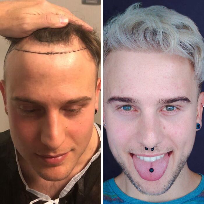 41 Plastic Surgery Glow-Ups That Will Make You Look Twice