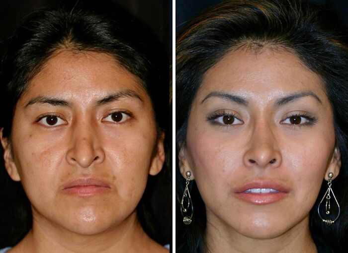 41 Plastic Surgery Glow-Ups That Will Make You Look Twice