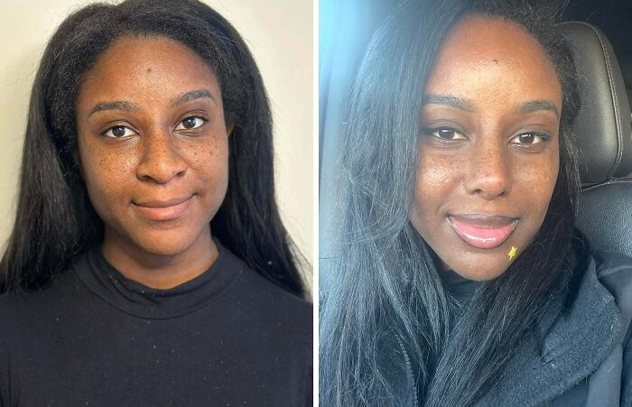 41 Plastic Surgery Glow-Ups That Will Make You Look Twice