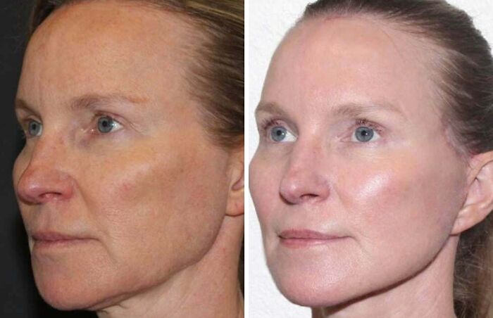 41 Plastic Surgery Glow-Ups That Will Make You Look Twice