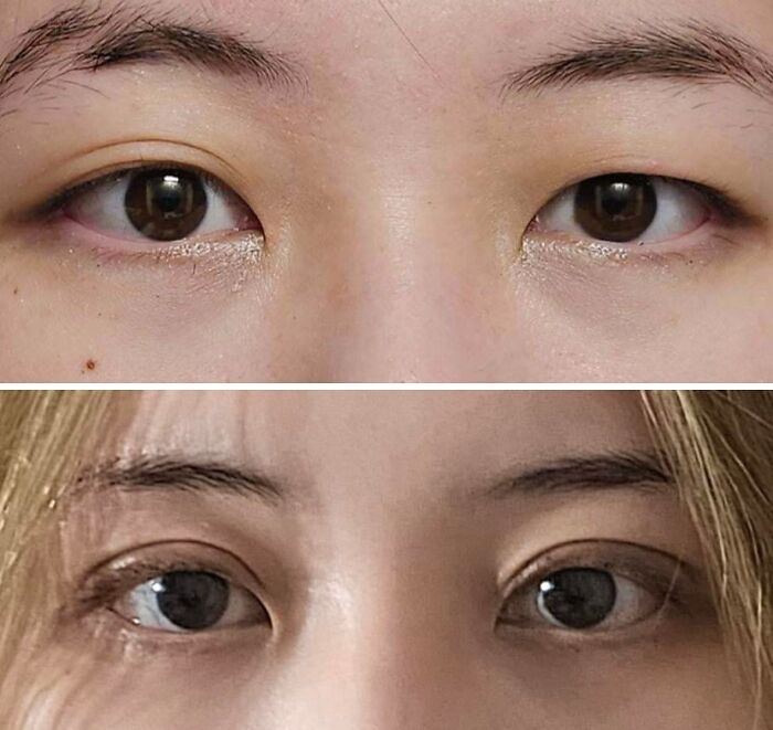 41 Plastic Surgery Glow-Ups That Will Make You Look Twice