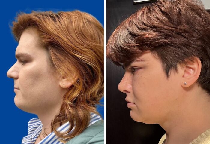 41 Plastic Surgery Glow-Ups That Will Make You Look Twice