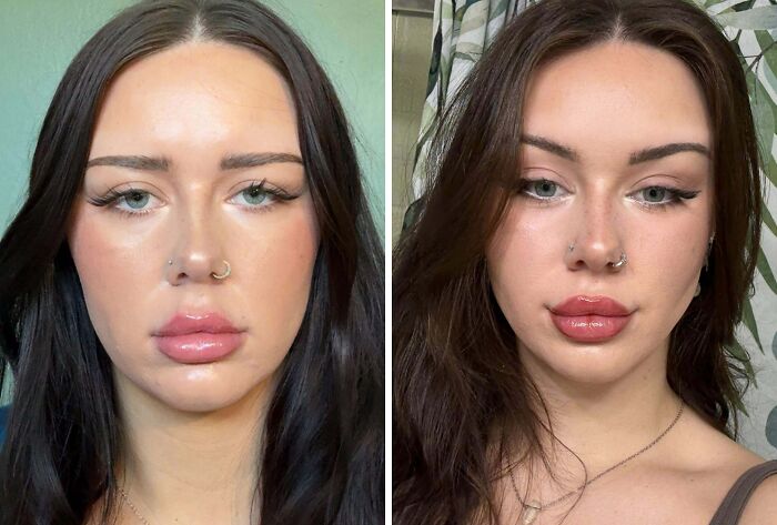 41 Plastic Surgery Glow-Ups That Will Make You Look Twice