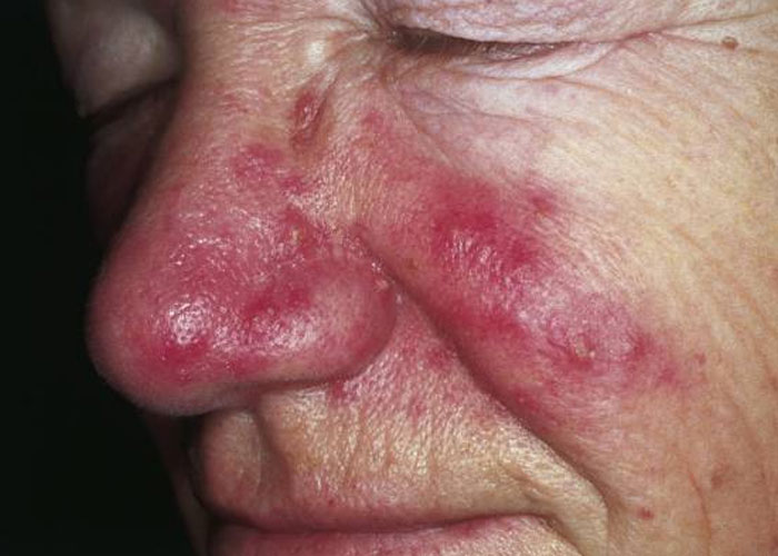 Invisible Pain? 40+ Medical Issues People Wish You Knew About