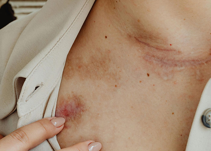 Invisible Pain? 40+ Medical Issues People Wish You Knew About