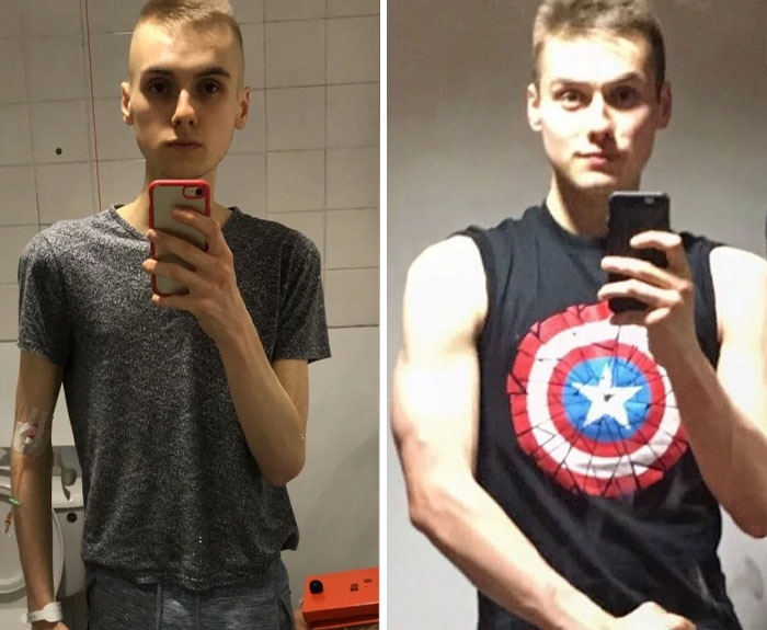 From 99lbs to 150lbs: One Guy’s Winning Battle Against Anorexia