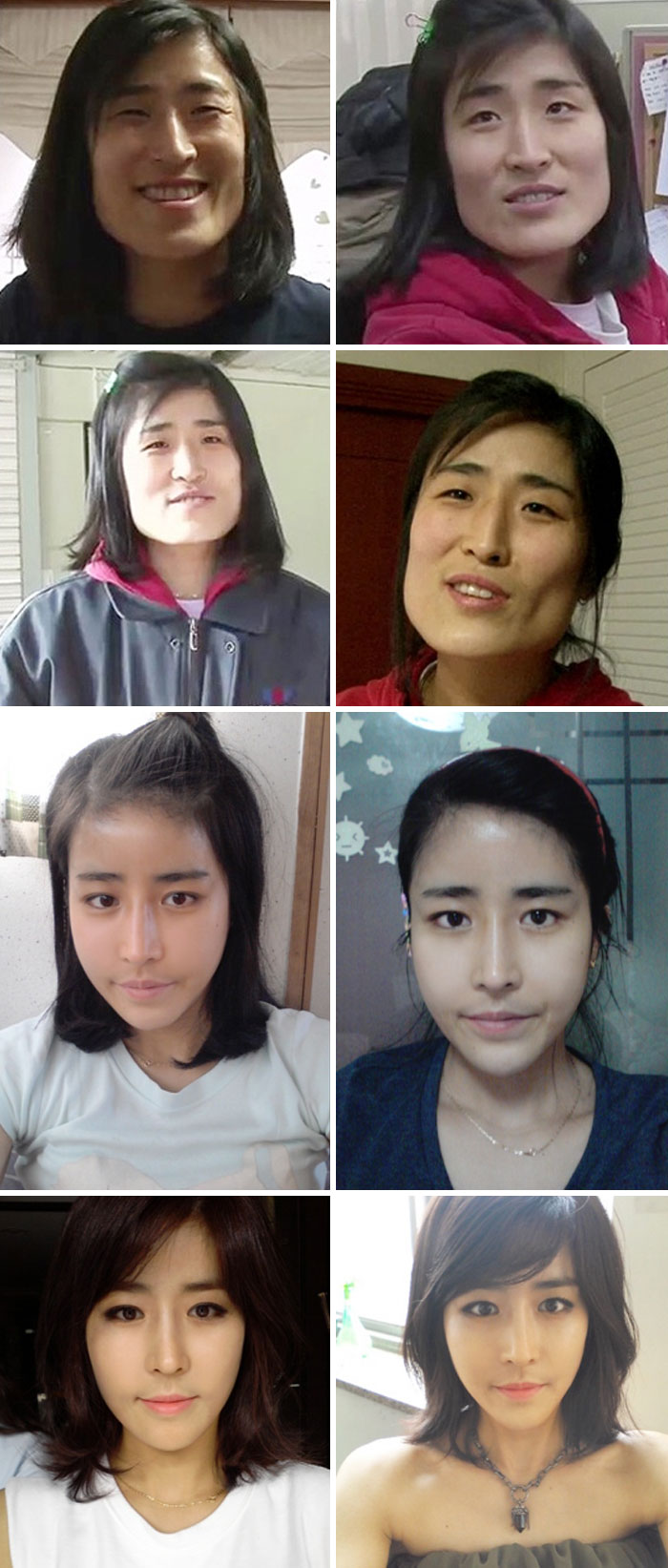 Plastic Surgery Wonders: Magic In The Making