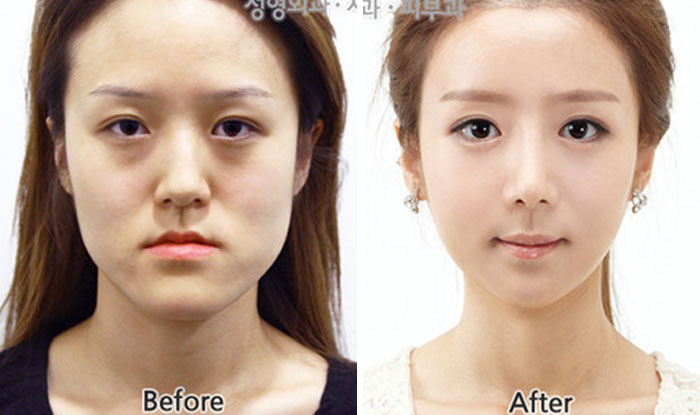 Korean Plastic Surgeons: Masters of Transformations