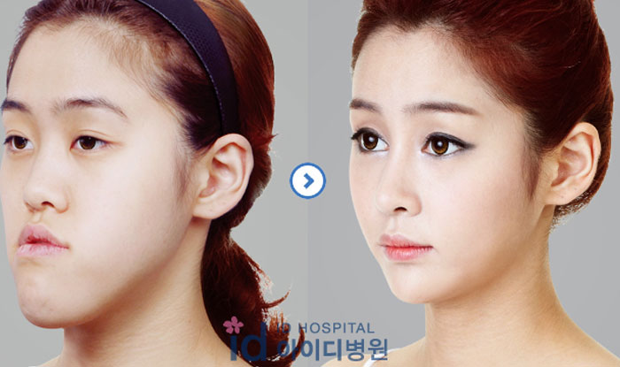 This One’s Winning!