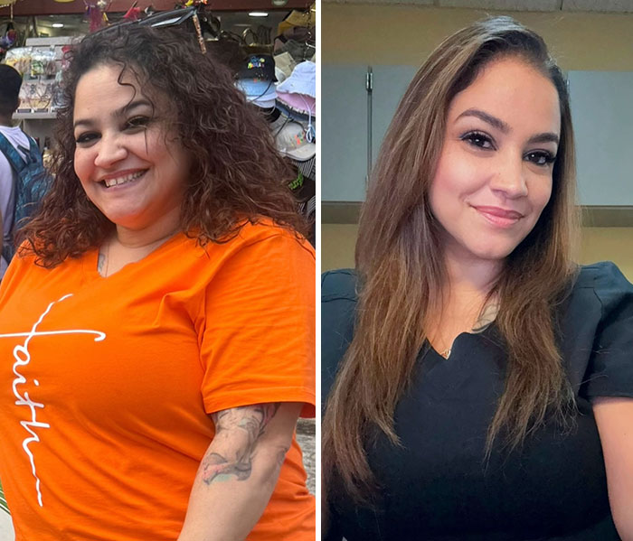 Wait, They Actually Shared Their Ozempic Face Transformations?!