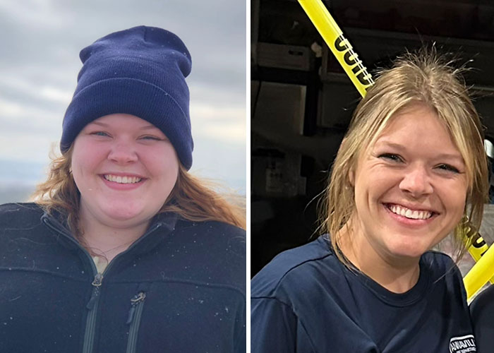 Wait, They Actually Shared Their Ozempic Face Transformations?!