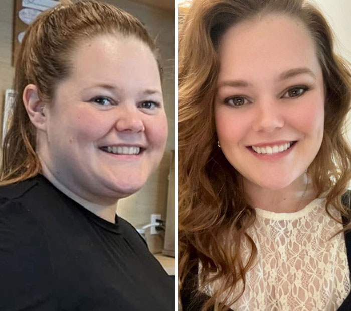 Wait, They Actually Shared Their Ozempic Face Transformations?!