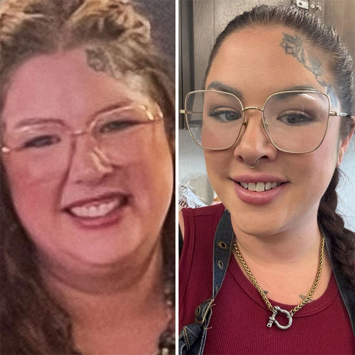 Wait, They Actually Shared Their Ozempic Face Transformations?!