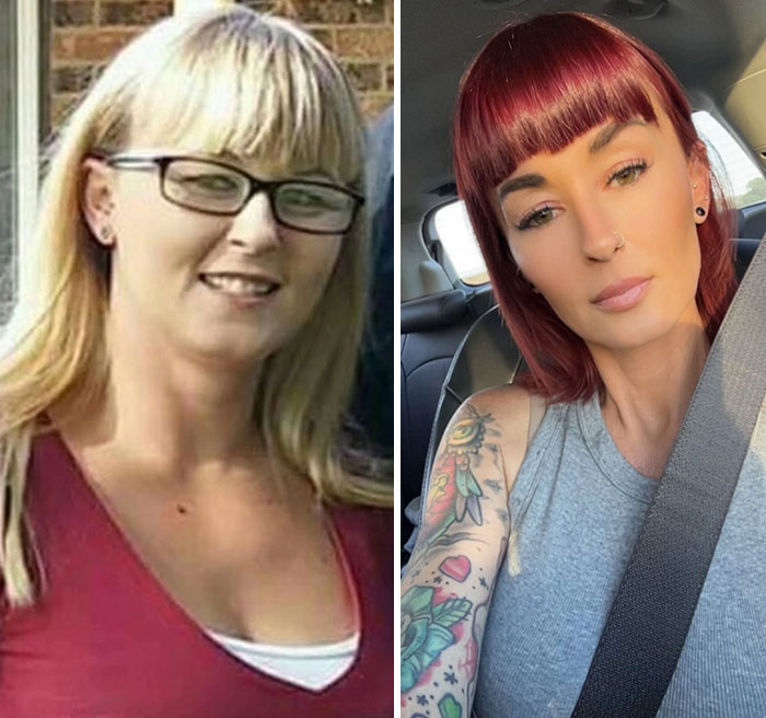 Wait, They Actually Shared Their Ozempic Face Transformations?!