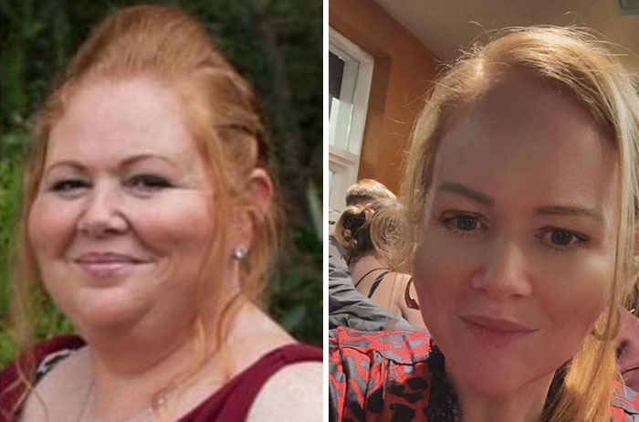 Wait, They Actually Shared Their Ozempic Face Transformations?!