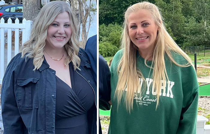 Wait, They Actually Shared Their Ozempic Face Transformations?!