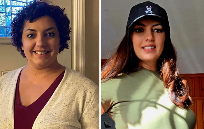 Wait, They Actually Shared Their Ozempic Face Transformations?!