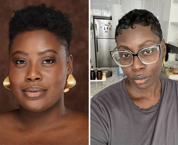 Wait, They Actually Shared Their Ozempic Face Transformations?!