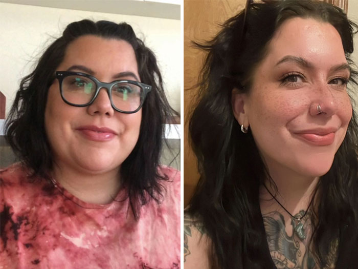 Wait, They Actually Shared Their Ozempic Face Transformations?!